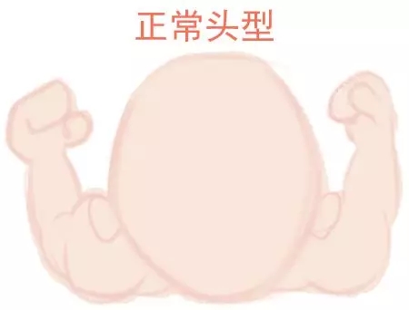 宝宝圆头好照旧扁头好？？？？？？这些神秘许多爸妈都不知道1.webp.jpg